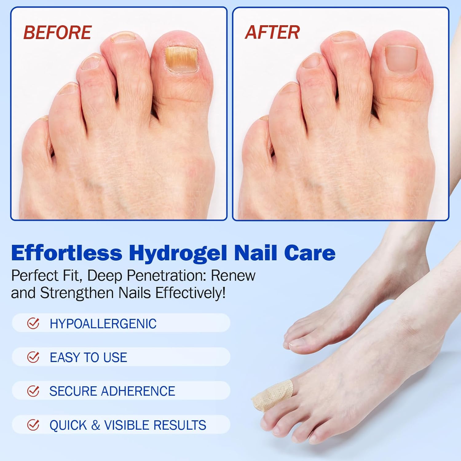 Fungal Nail Patches for Toenail Care – 21 PCS Extra Strength Overnight Hydrogel Nail Repair Patches for Damaged, Thick & Discolored Nails, 8 Hour Moisturizing Toenail Treatment for Men Women