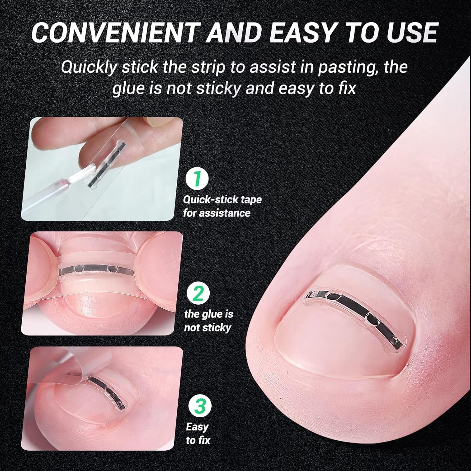 Titanium Alloy Ingrown Toenail Treatment, Nail Tools, and Ingrown Toenail Removal Kit Specially Designed for Curved Nail Repair and Ingrown Toenail Corrector (0.59/0.67in)