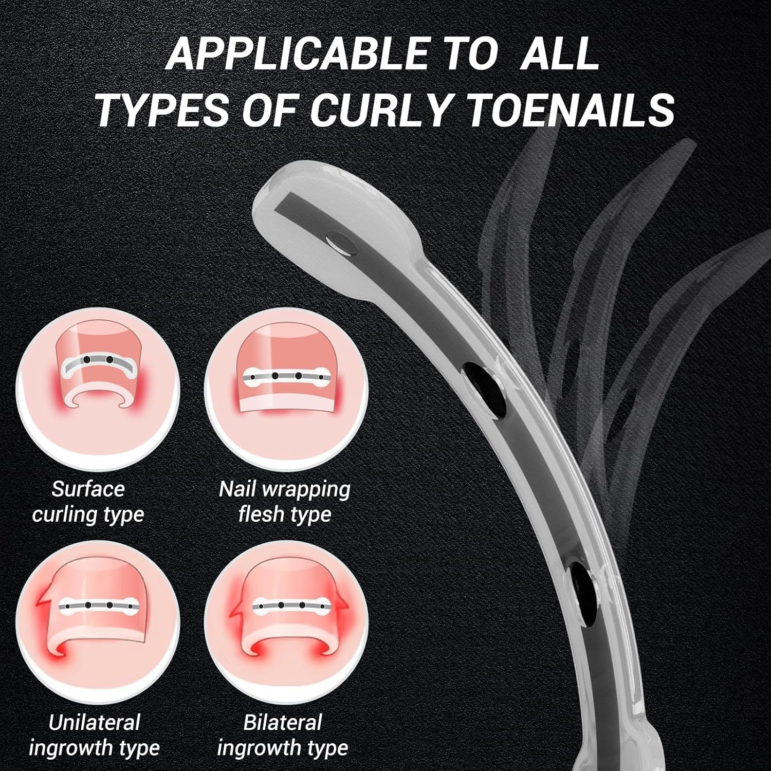 Titanium Alloy Ingrown Toenail Treatment, Nail Tools, and Ingrown Toenail Removal Kit Specially Designed for Curved Nail Repair and Ingrown Toenail Corrector (0.59/0.67in)