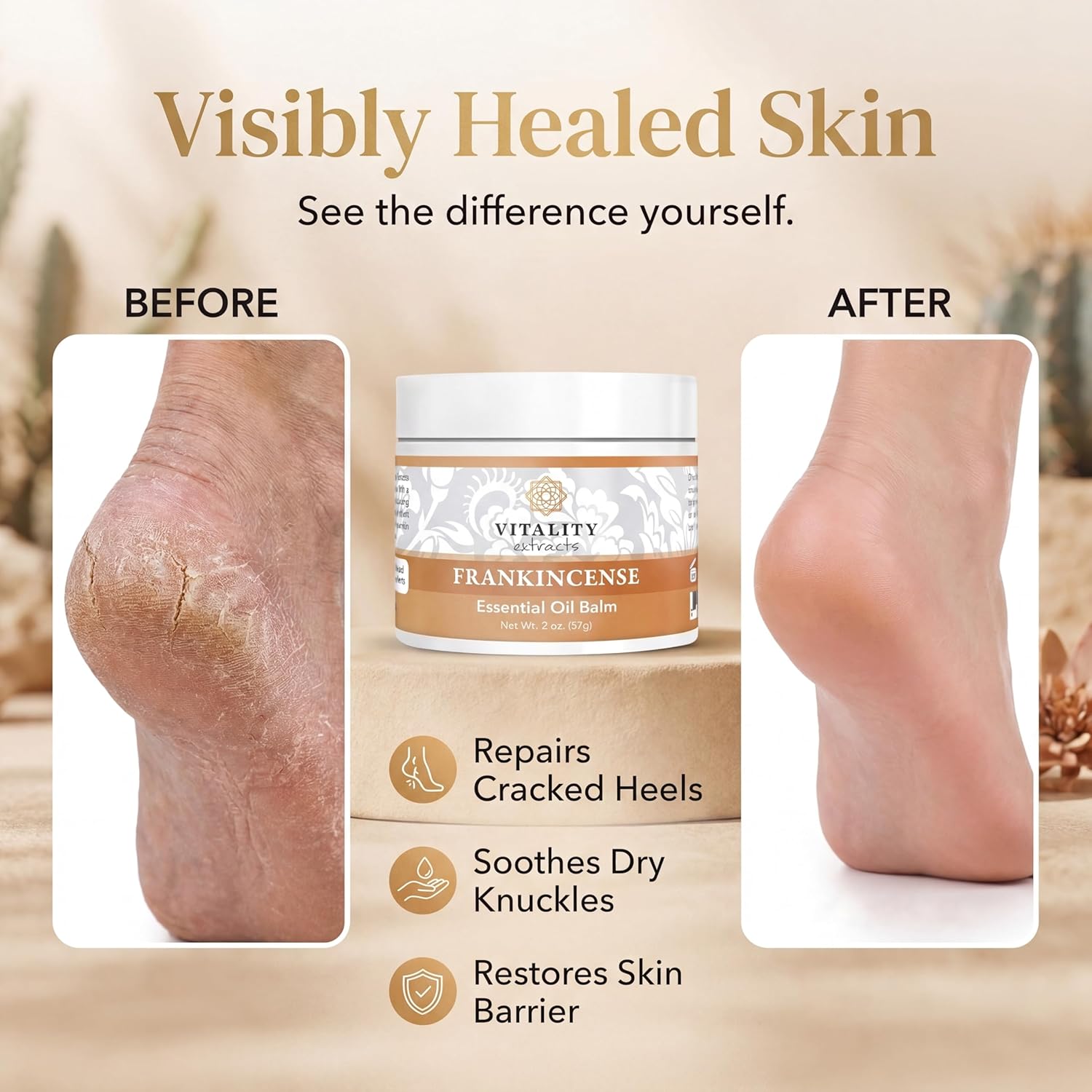 Vitality Extracts Frankincense Balm - 2oz, Boswellia Serrata, Beeswax, Olive Oil, Moisturizer for Dry, Cracked Skin, All Skin Types